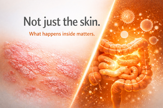 Psoriasis from the inside: why your routine matters more than you think